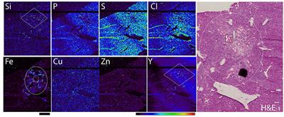 Use of X-Ray Fluorescence Microscopy for Studies on Research Models of Hepatocellular Carcinoma